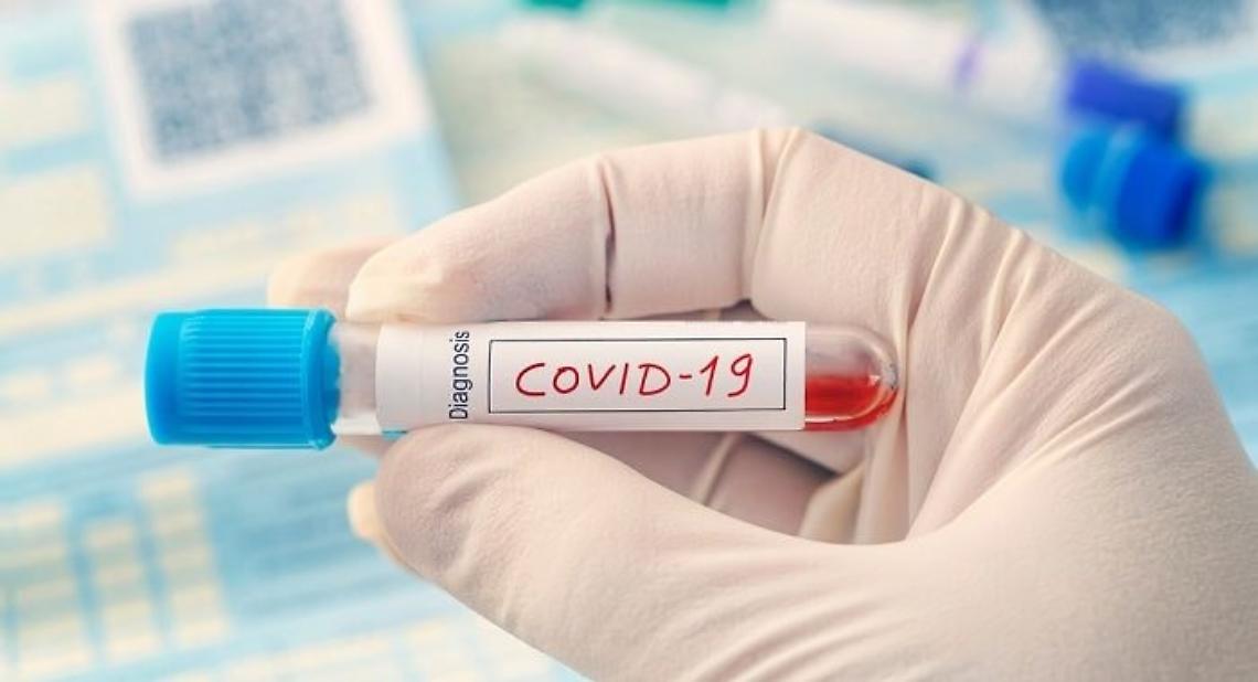 Coronavirus: la Regione Piemonte acquista 70 mila test per gli esami sierologici sul personale sanitario