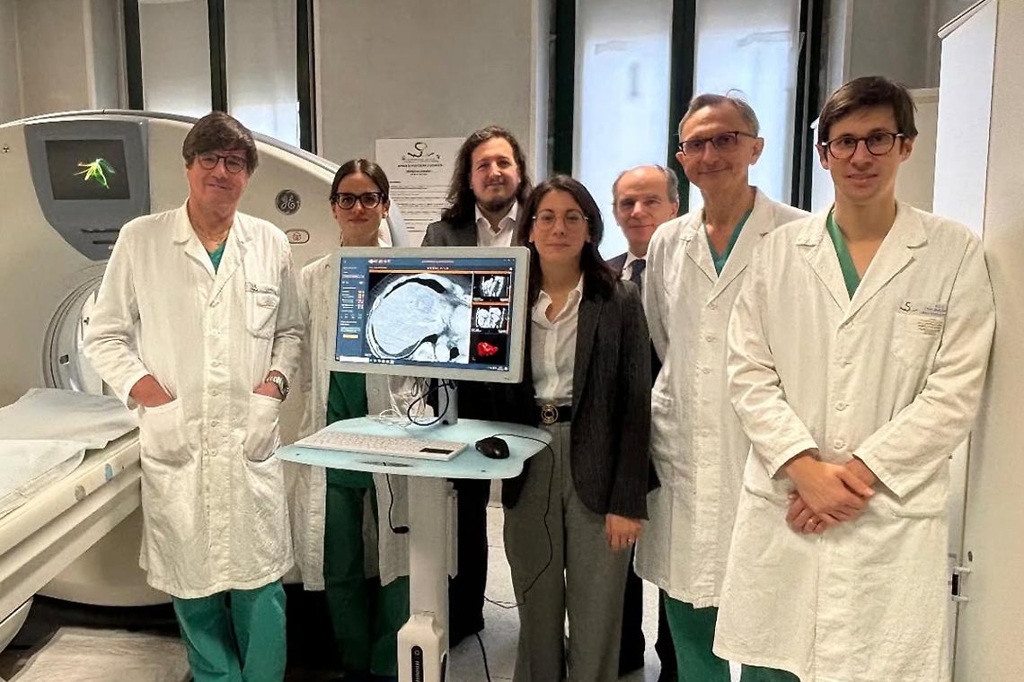 Curare i tumori del fegato con l'AI