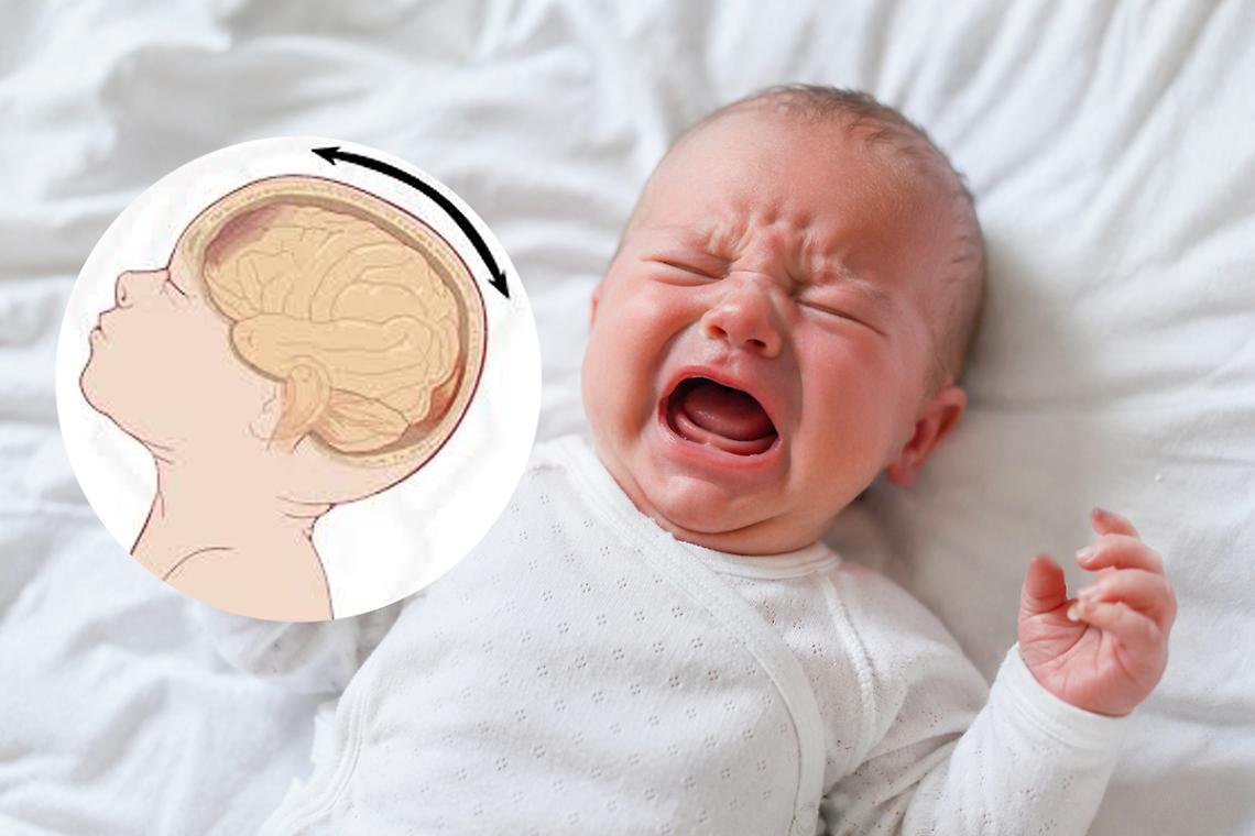 Cos'&egrave; la "Shaken baby sindrome" e perch&eacute; pu&ograve; essere fatale per i neonati