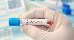 Coronavirus: la Regione Piemonte acquista 70 mila test per gli esami sierologici sul personale sanitario