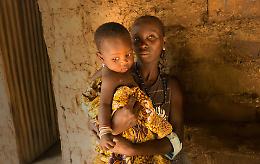 Compra il miele AIFO e dai una mano per combattere la lebbra: ecco le date nelle parrocchie

