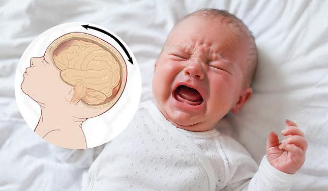 Cos'&egrave; la "Shaken baby sindrome" e perch&eacute; pu&ograve; essere fatale per i neonati